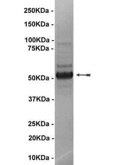 Eurofins DiscoverX p70 S6 Kinase Protein, Active 10 &mu;g | Buy Online | Eurofins DiscoverX | Fisher Scientific